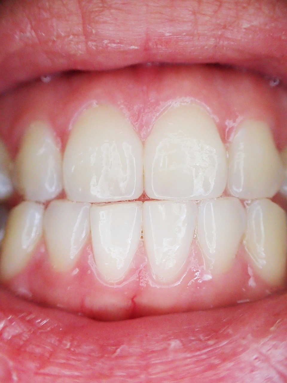 Detailed view of the gumline and tooth structure.